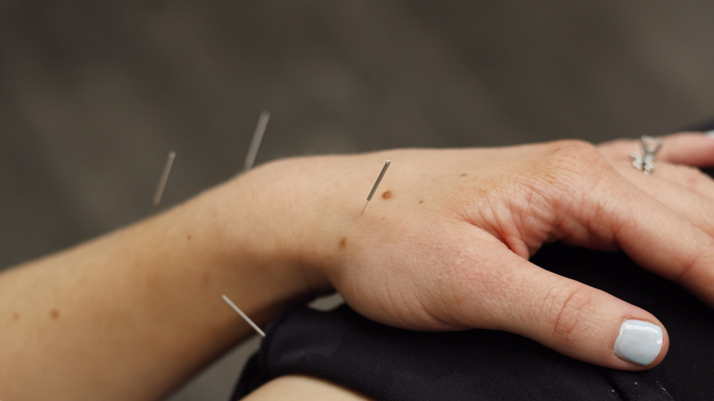 Acupuncture for infertility Sunset Hills
